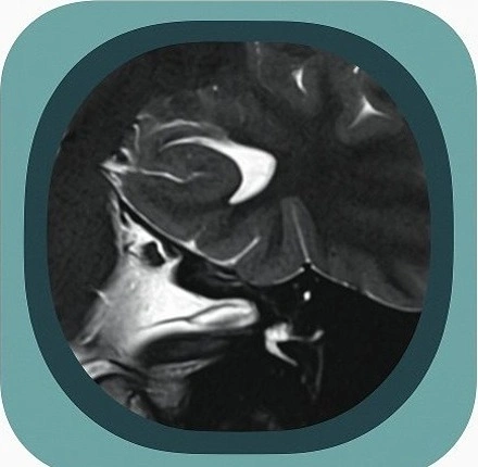 mri hippocampus anatomy icon